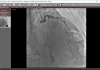 心脏造影视频播放器 破解版 | RadiAnt DICOM Viewer（2025.1）
